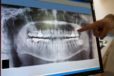 woman touching painful jaw