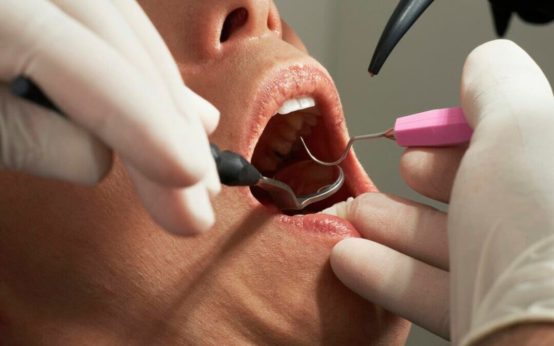 7 Tips for Choosing a Dentist in Woodbridge